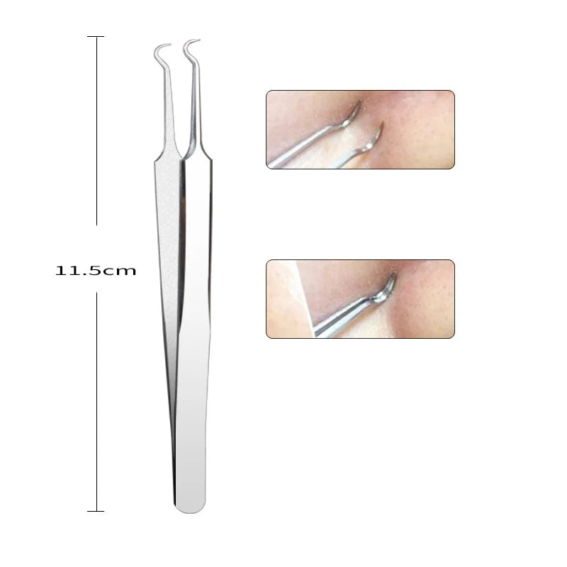 Blackhead Removal Tool Kit