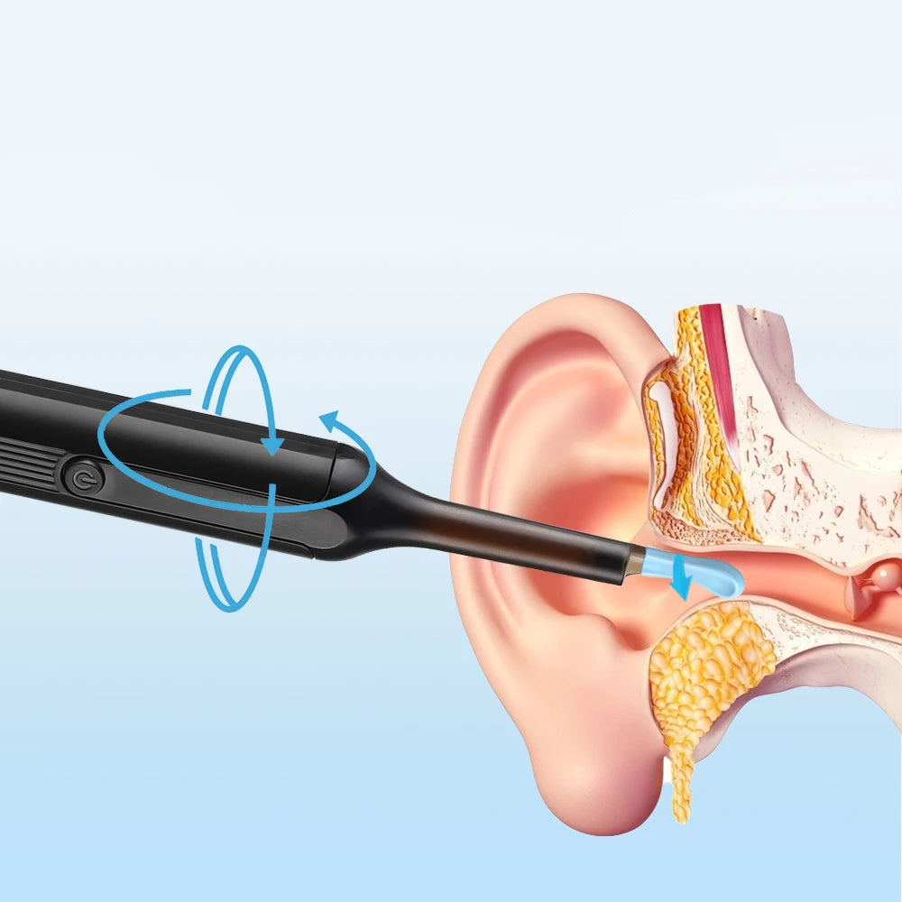 Smart Visual LED Ear Cleaner